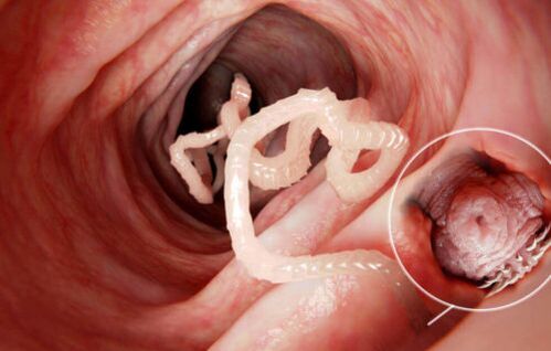 el gusano es un parásito en el cuerpo humano
