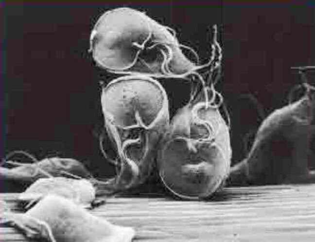 parásito protozoario giardia
