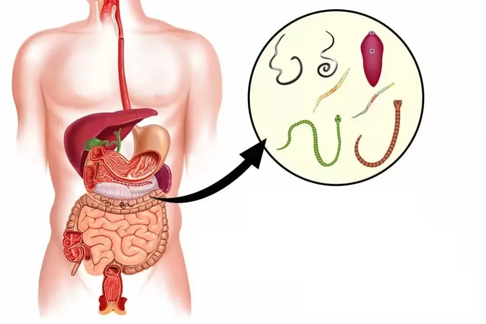 parásitos en el intestino humano